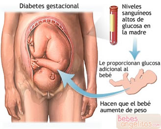 Cuidados en el embarazo y diabetes